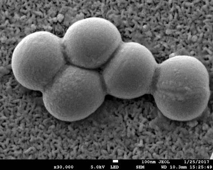 Представитель Семейства Lipomycetaceae